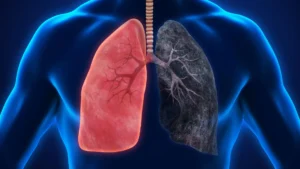 The Unclear Horizon: Investigating the Potential Cancer Risks of Marijuana Use