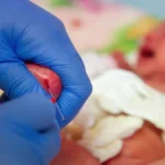 Transforming Pediatric Oncology: Could Genomic Newborn Screening Be the Future of Cancer Prevention?