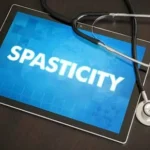 Unlocking Lifelong Mobility: The Urgent Call for Early Selective Dorsal Rhizotomy Evaluation in Children with Spasticity