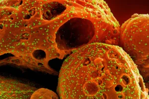 Unveiling the "Double-Edged Sword": How SARS-CoV-2’s Nucleocapsid Protein Fuels Severe COVID-19