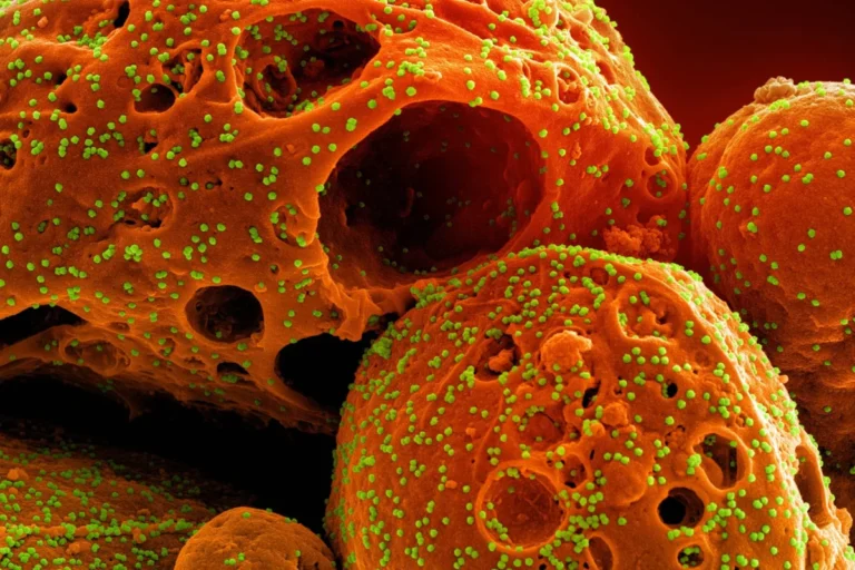 Unveiling the "Double-Edged Sword": How SARS-CoV-2’s Nucleocapsid Protein Fuels Severe COVID-19