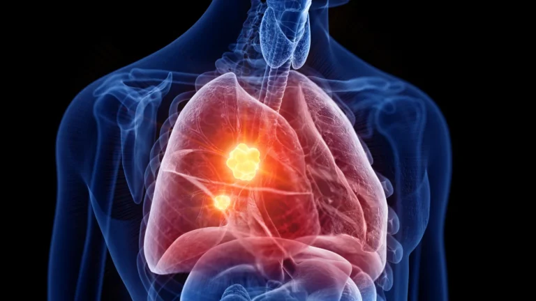 A Breakthrough in the Shadows: Novel Strategy Offers New Hope for Mesothelioma Patients
