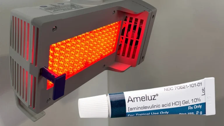 A New Frontier in Dermatology: FDA Greenlights Non-Surgical Photodynamic Therapy for Superficial Basal Cell Carcinoma
