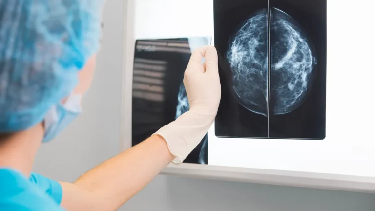 AI-Driven Mammography: Vara’s Autonomous Triage Receives EU Regulatory Green Light