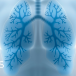 Beyond the Airways: New Research Links Severe Asthma to Structural Changes in the Brain