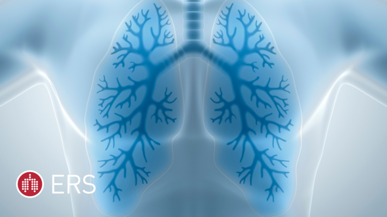 Beyond the Airways: New Research Links Severe Asthma to Structural Changes in the Brain
