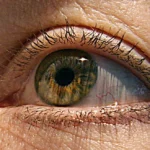 Beyond the Drop: Can a Novel Irish Implant Solve the Glaucoma Surgery Crisis?