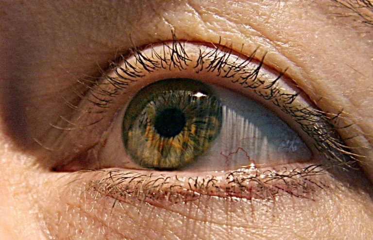 Beyond the Drop: Can a Novel Irish Implant Solve the Glaucoma Surgery Crisis?