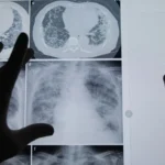 Beyond the Slide: How One Professor is Humanizing Medical Education Through His Own Cancer Journey