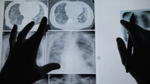 Beyond the Slide: How One Professor is Humanizing Medical Education Through His Own Cancer Journey
