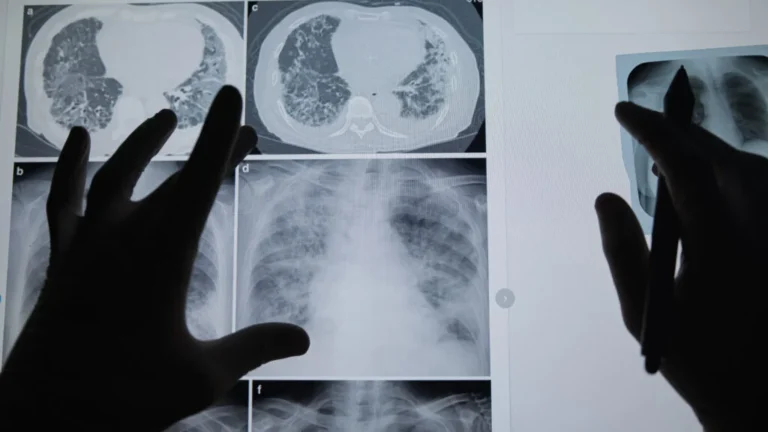 Beyond the Slide: How One Professor is Humanizing Medical Education Through His Own Cancer Journey