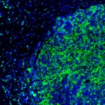 Breaking the OX40 Curse: Inhibrx Data Highlights Potential—and Limitations—in Head and Neck Cancer