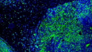 Breaking the OX40 Curse: Inhibrx Data Highlights Potential—and Limitations—in Head and Neck Cancer