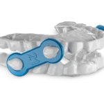Bridging the Gap: Dentulu Health and Apex Dental Sleep Lab Transform the Oral Appliance Therapy Workflow