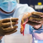 Bridging the Gap: Why Policy-Oriented Research is the Lifeline of the U.S. Kidney Transplant System