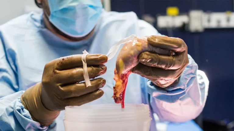 Bridging the Gap: Why Policy-Oriented Research is the Lifeline of the U.S. Kidney Transplant System