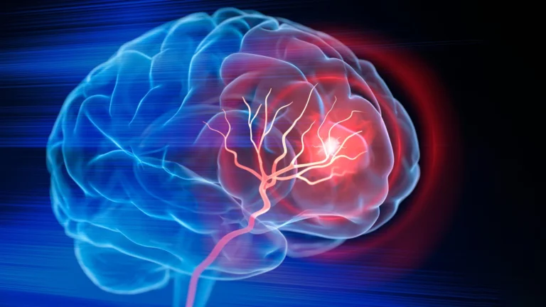 Bridging the Void: Duke Engineers Develop Injectable Biomaterial to Heal Stroke-Damaged Brains