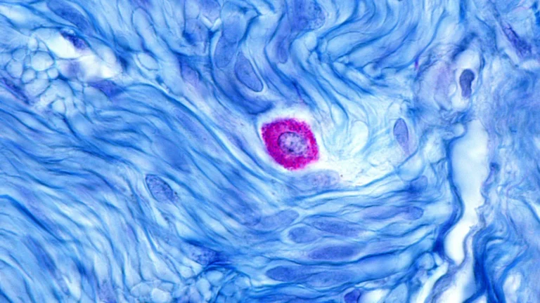 Celldex’s Barzolvolimab Shows Unparalleled Efficacy in Chronic Hives, Despite Anaphylaxis Safety Concerns