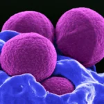 Challenging the Paradigm: Landmark SOLARIO Trial Suggests Shorter Antibiotic Courses for Orthopedic Infections