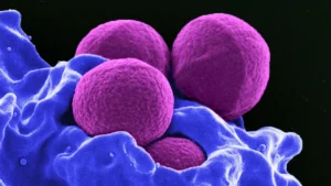 Challenging the Paradigm: Landmark SOLARIO Trial Suggests Shorter Antibiotic Courses for Orthopedic Infections