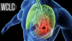 Clinical Setback: Local Consolidative Therapy Fails to Enhance Outcomes in Metastatic NSCLC Patients