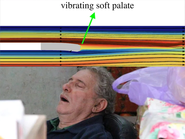 Decoding the Night: New 3D Computational Model Sheds Light on the Mechanics of Snoring