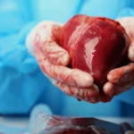Expanding the Horizon of Hope: The Evolution and Validation of DCD Heart Transplantation