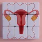 From Ovaries to Systems: The Paradigm Shift of PMOS and What It Means for the Chronic Illness Community