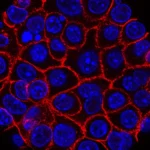 GSK Bets $1.4 Billion on Novel "ATTC" Cancer Therapy in Landmark Hutchmed Deal