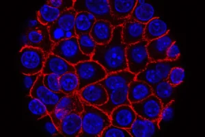 GSK Bets $1.4 Billion on Novel "ATTC" Cancer Therapy in Landmark Hutchmed Deal