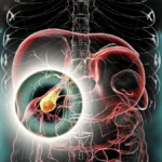 New Safety Signal: GLP-1 Receptor Agonists Linked to Gallbladder Risks in Adolescents