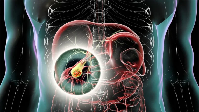 New Safety Signal: GLP-1 Receptor Agonists Linked to Gallbladder Risks in Adolescents