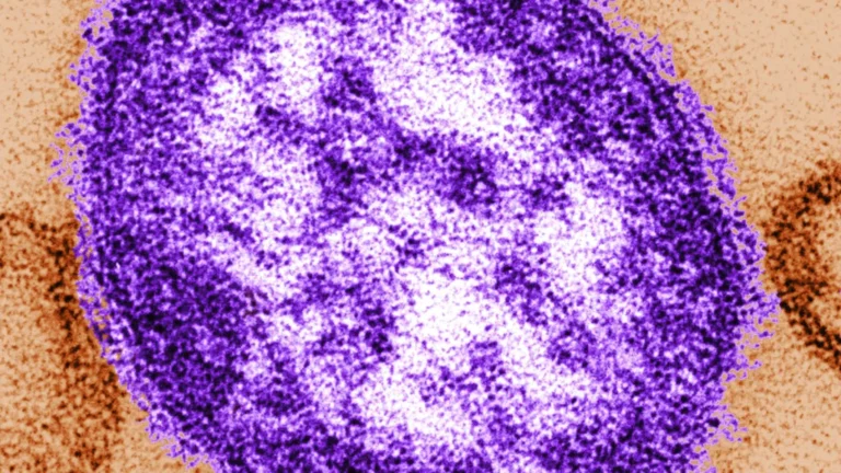 Public Health Crisis: Pennsylvania Records Third Measles-Related Death as Discrepancies Emerge in National Reporting