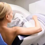 Rethinking the Risks: New Study Challenges Long-Standing Fears of Breast Cancer Overdiagnosis