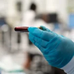 The Frontier of Liquid Biopsy: Evaluating the Potential and Risks of Grail’s Galleri Test