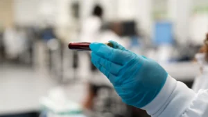 The Frontier of Liquid Biopsy: Evaluating the Potential and Risks of Grail’s Galleri Test