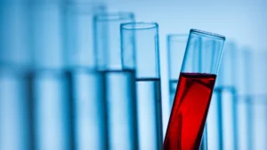 The Future of Diagnostic Testing: A Looming Clash Over Medicare Payment Reform