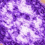 The Measles Crisis: Pennsylvania Coroner Confirms Infant Deaths Amidst National Political Firestorm