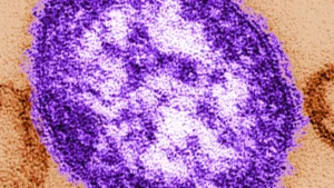 The Measles Crisis: Pennsylvania Coroner Confirms Infant Deaths Amidst National Political Firestorm