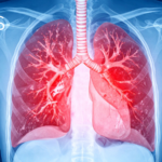 The Power of Joy: New Clinical Evidence Suggests Laughter Therapy Could Revolutionize COPD Management