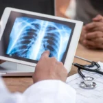 The Structural Breaking Point: Why Radiology Needs an Architectural Revolution