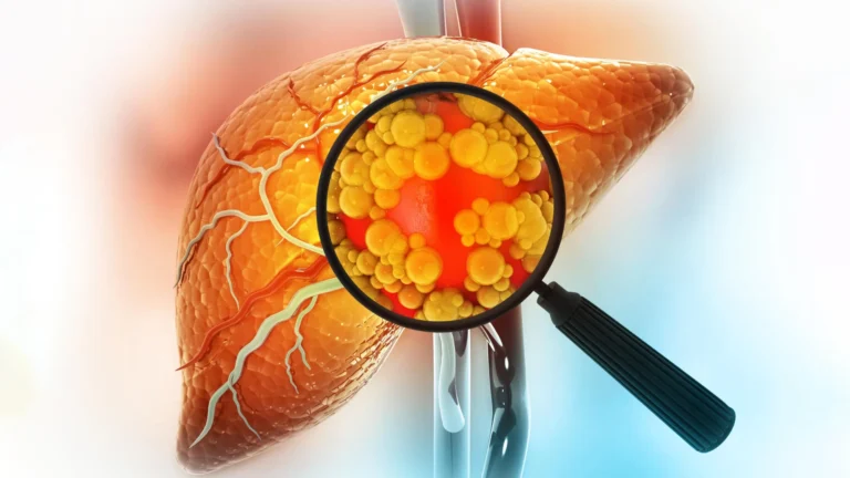 The "Sugar-Free" Mirage: New Research Challenges the Metabolic Safety of Sorbitol