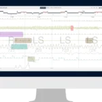 A New Benchmark for Sleep Medicine: EnsoData’s EnsoSleep Secures Historic AASM Full Autoscoring Certification
