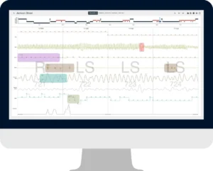 A New Benchmark for Sleep Medicine: EnsoData’s EnsoSleep Secures Historic AASM Full Autoscoring Certification