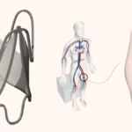 A New Era in Pediatric Cardiology: FDA Approves First Growth-Adaptive Heart Valve
