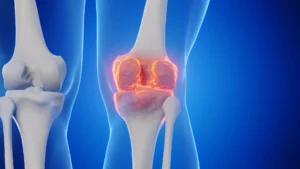 A Potential Breakthrough in Joint Health: Blocking a "Gerozyme" to Reverse Arthritis