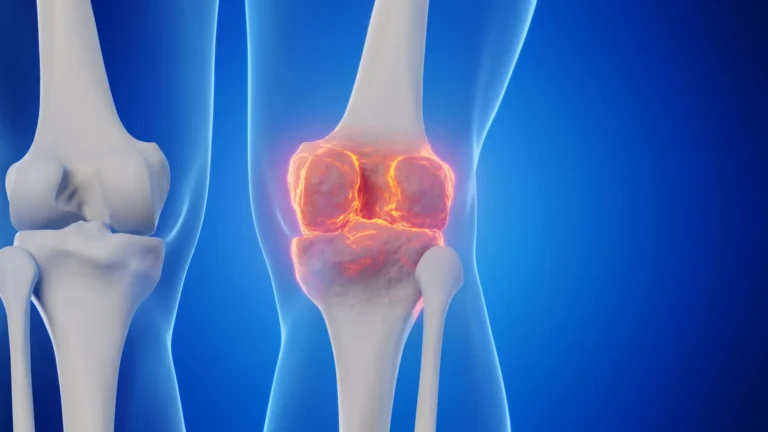 A Potential Breakthrough in Joint Health: Blocking a "Gerozyme" to Reverse Arthritis