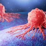 A Silent Surge: The Complex Mystery Behind Rising Cancer Rates in Younger Adults