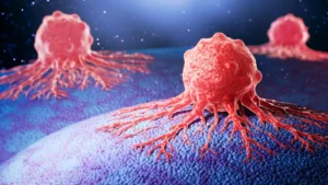 A Silent Surge: The Complex Mystery Behind Rising Cancer Rates in Younger Adults