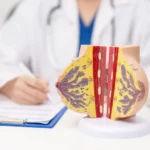 Beyond Aesthetics: New Research Links Macromastia to Chronic Pain and Sleep Disorders